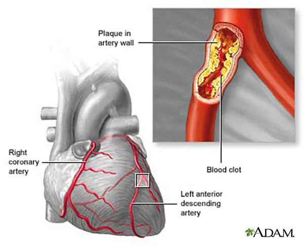 Coronary Artery Disease Prof Teoman Kilic
