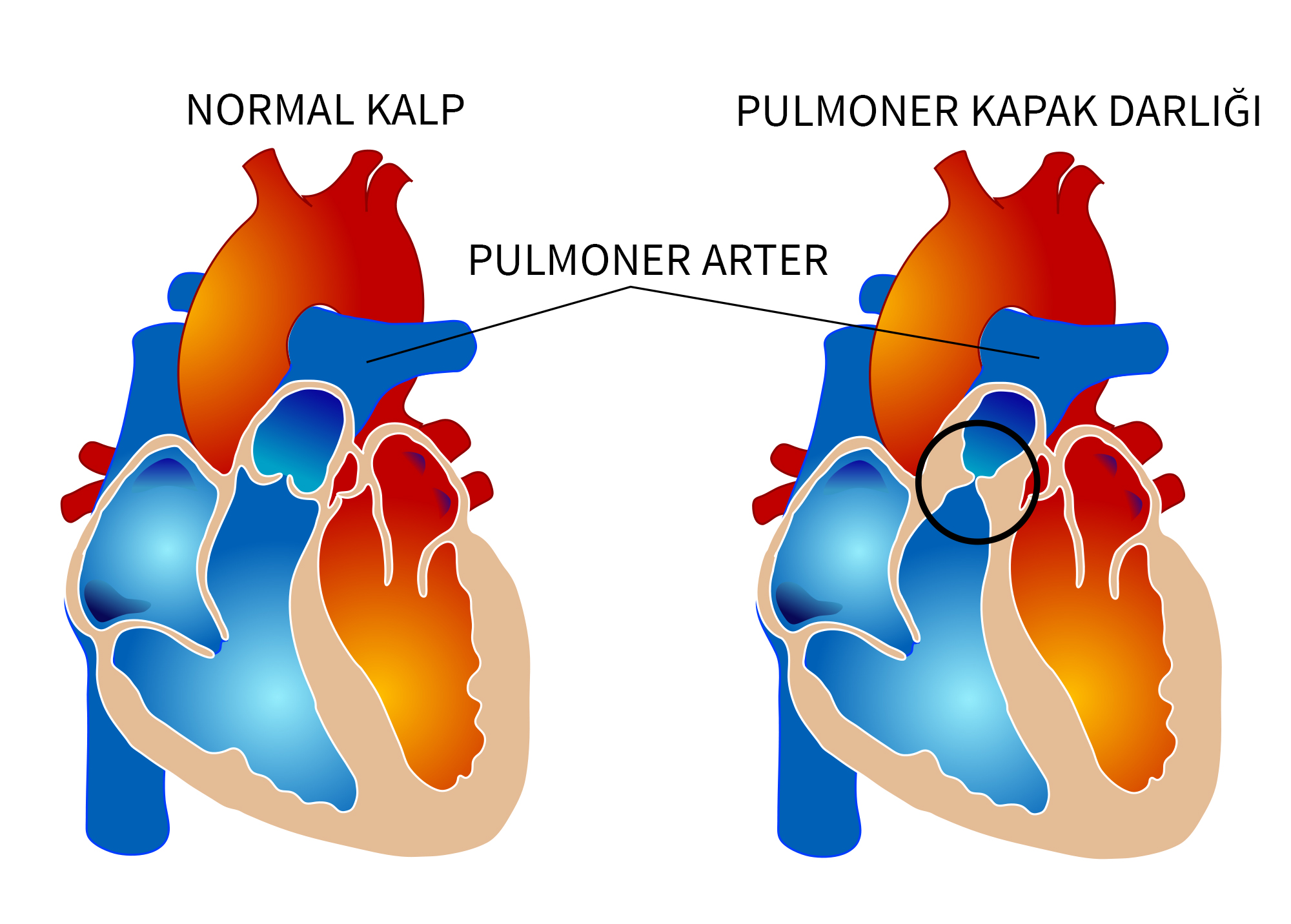 Pulmoner Darl k Prof Dr Teoman K l 